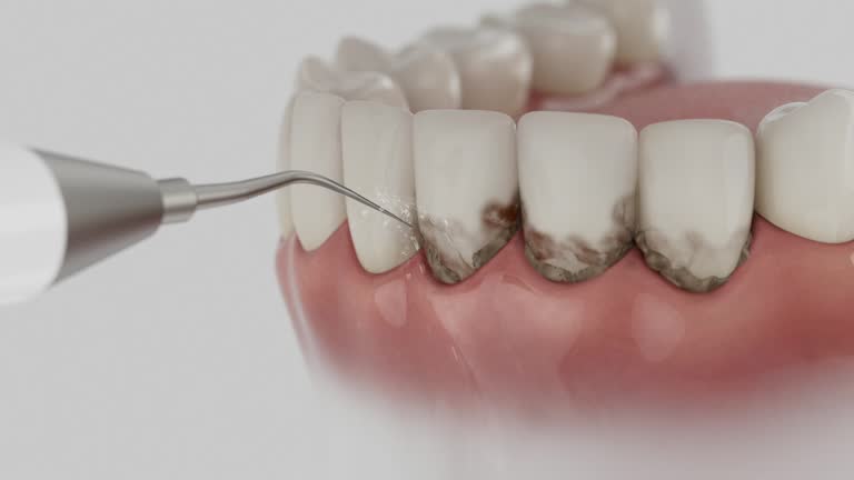 Reliable Dental contractor in Plummer, ID by Smile Center Dentistry